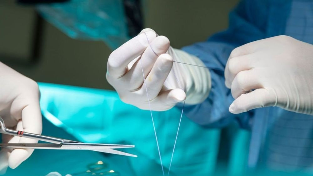 Ταχύτερη επούλωση πληγών με ράμματα που παράγουν ηλεκτρικό φορτίο!