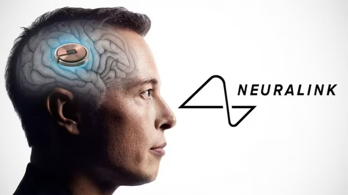 Neuralink: Το εμφύτευμα επέτρεψε σε παράλυτη να γράψει μετά από 20 χρόνια