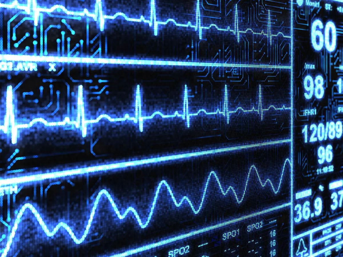 Η AI εντοπίζει καρδιακή ανεπάρκεια σε 2 δευτερόλεπτα μέσω απλού ηλεκτροκαρδιογραφήματος