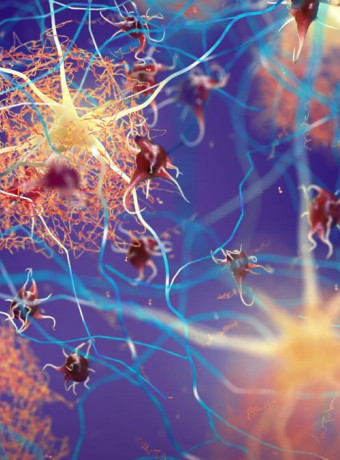 Νέα στρατηγική στην αντιμετώπιση της Νόσου Alzheimer πριν εκδηλωθεί image