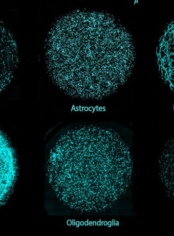 miBrains: Το MIT έφτιαξε «μίνι ανθρώπινα μυαλά» για τη μελέτη της Νόσου Alzheimer image
