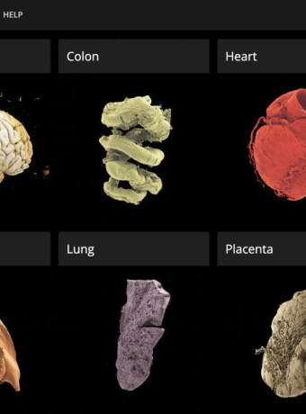 Human Organ Atlas: Ο πρώτος τρισδιάστατος χάρτης ανθρώπινων οργάνων με ανάλυση επιπέδου 1 μικρομέτρου! image