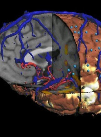 Human Brain Project: Προσομοίωση του ανθρώπινου εγκεφάλου με υπερυπολογιστή [Video] image