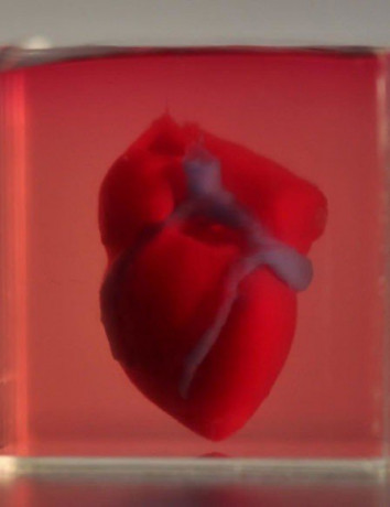 Ερευνητές κατασκεύασαν την πρώτη 3D printed καρδιά από κύτταρα και ιστό ασθενούς image