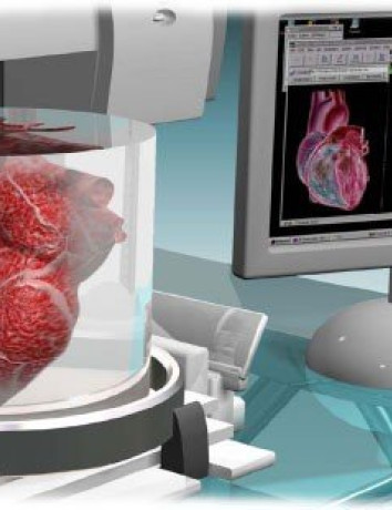 3D εκτύπωση ανθρωπίνων οργάνων για μοσχεύματα κατά παραγγελία, υπόσχεται εταιρεία στις ΗΠΑ [Videos] image