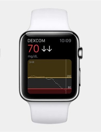 Apple: Ετοιμάζει λειτουργία διαρκούς μέτρησης του σακχάρου στο αίμα για το Apple Watch image