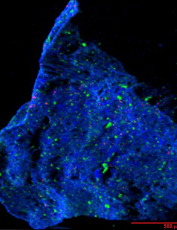 Alt text