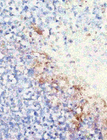 Η τεχνολογία CRISPR ανοίγει νέο μέτωπο κατά του ανθεκτικού καρκίνου του πνεύμονα image