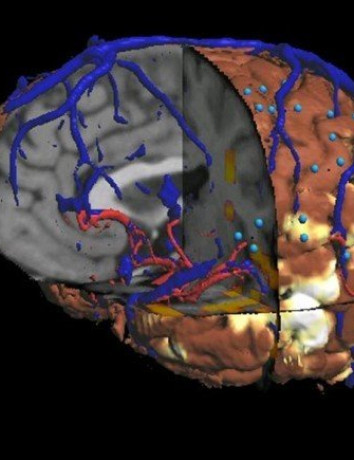 Human Brain Project: Προσομοίωση του ανθρώπινου εγκεφάλου με υπερυπολογιστή [Video] image