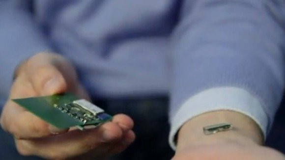 Εξετάσεις αίματος μέσω εμφυτευμένου microchip. Το τέλος των βελόνων; [Video] image