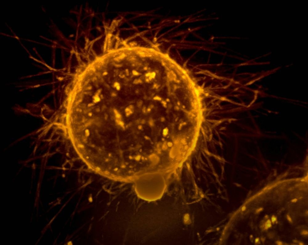 Εμβόλιο mRNA αντιμετώπισε θανατηφόρο καρκίνο του εγκεφάλου σε ανθρώπους image
