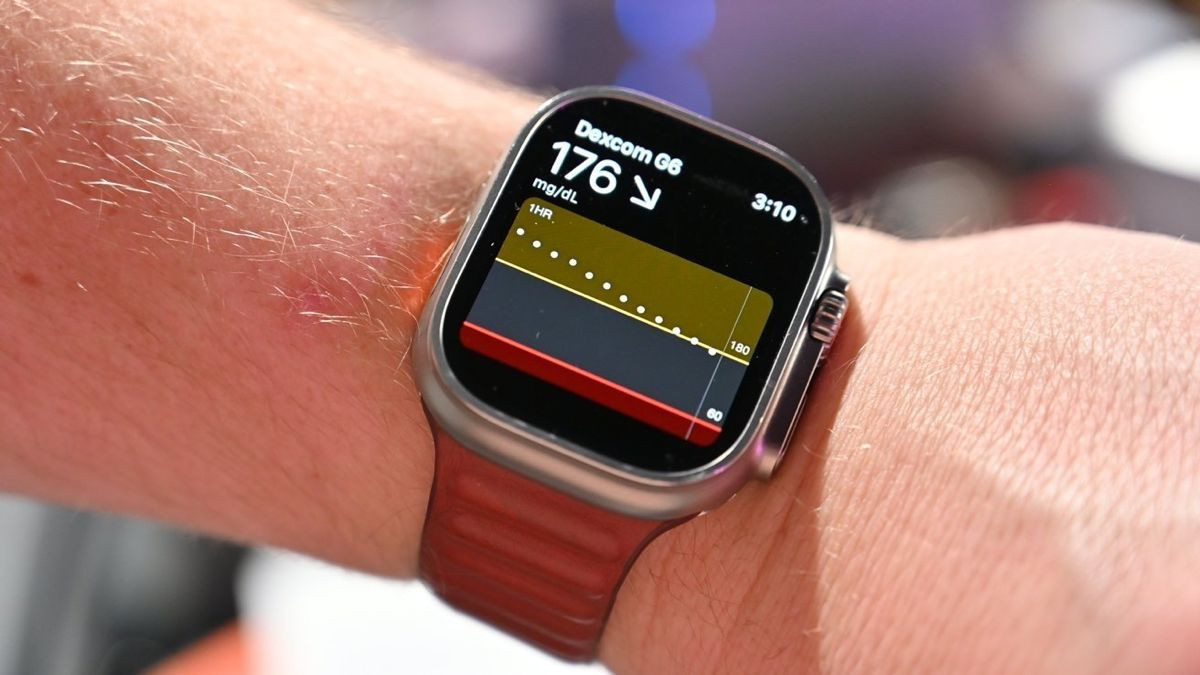Apple Watch Series 13: Θα είναι το πρώτο με δυνατότητα μέτρησης σακχάρου στο αίμα; image