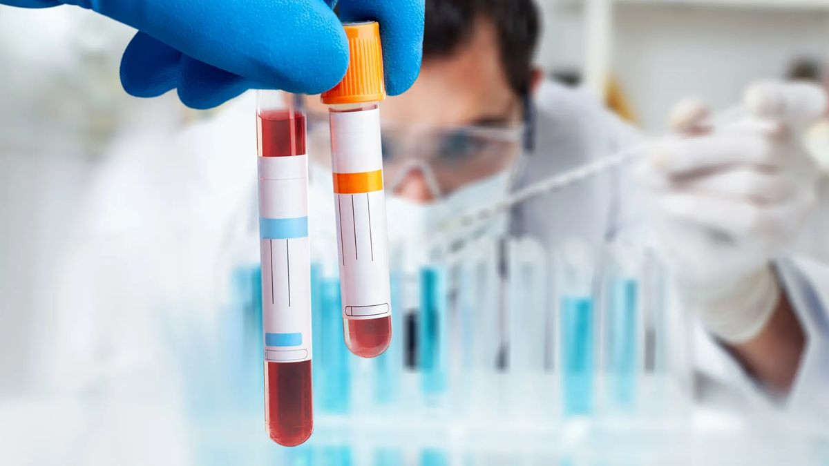 Σύντομα μια απλή αιματολογική εξέταση θα προβλέπει την πορεία της νόσου Alzheimer image