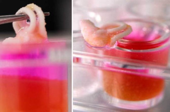 3D printing οστών απευθείας στο σώμα του ασθενή με ειδικό κεραμικό υλικό [Video] image