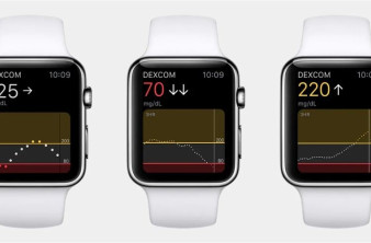 Apple: Ετοιμάζει λειτουργία διαρκούς μέτρησης του σακχάρου στο αίμα για το Apple Watch image