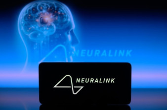 Ο πρώτος άνθρωπος με εμφύτευμα της Neuralink σε δράση! [Video] image