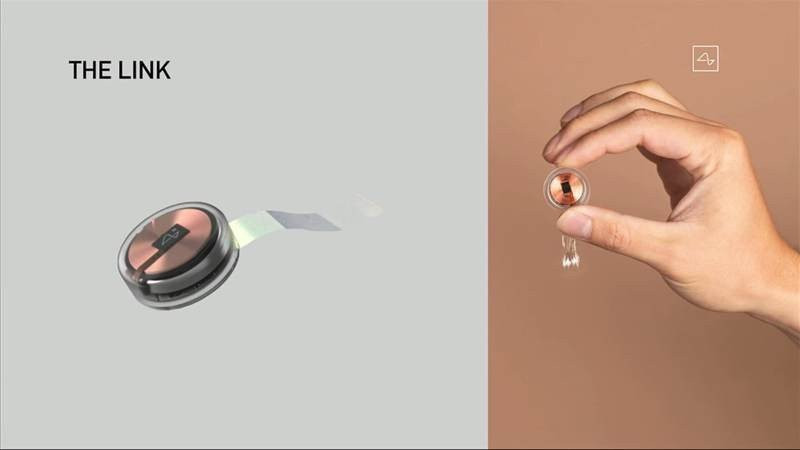 Neuralink: Ο Elon Musk ετοιμάζει τη νέα εποχή με το εμφύτευμα για τον εγκέφαλο | 