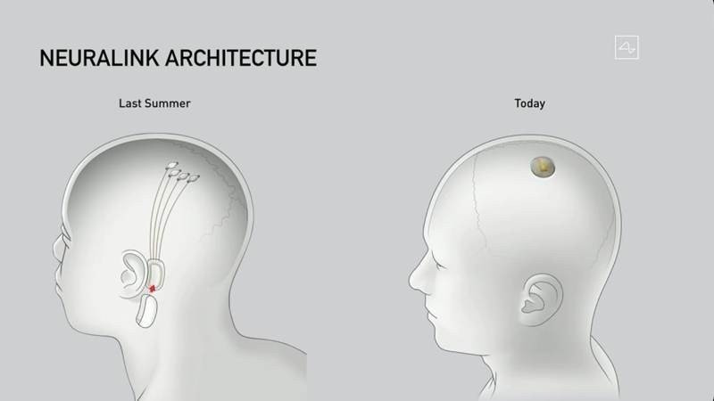 Neuralink: Ο Elon Musk ετοιμάζει τη νέα εποχή με το εμφύτευμα για τον εγκέφαλο | 